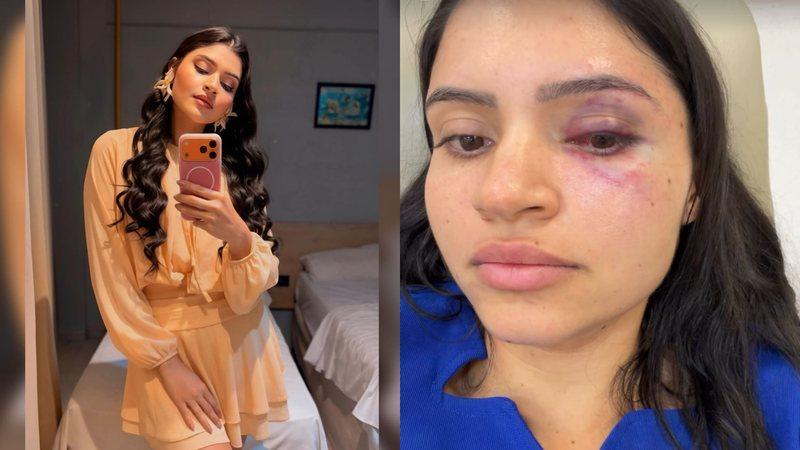 Técnica de enfermagem é agredida e sufocada pelo marido em Parnamirim